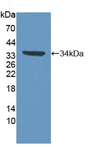 Western blot - Anti-CD93 antibody (AB231960), expandable thumbnail