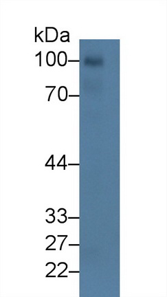 Western blot - Anti-CD93 antibody (AB231960), expandable thumbnail