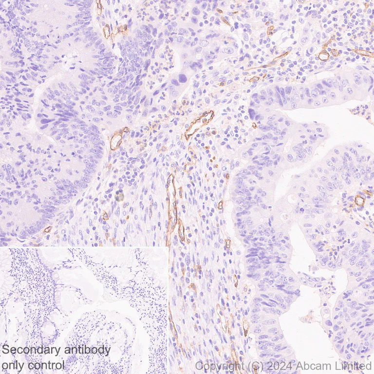 Immunohistochemistry (Formalin/PFA-fixed paraffin-embedded sections) - Anti-CD93 antibody [EPR29742-513] (AB322708)