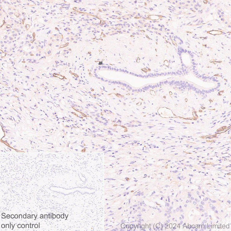 Immunohistochemistry (Formalin/PFA-fixed paraffin-embedded sections) - Anti-CD93 antibody [EPR29742-513] (AB322708)