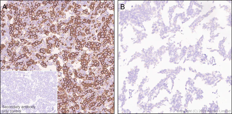Immunohistochemistry (Formalin/PFA-fixed paraffin-embedded sections) - Anti-CD93 antibody [EPR29742-513] (AB322708)
