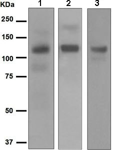 Western blot - Anti-CD93 antibody [EPR5386] (AB134079), expandable thumbnail