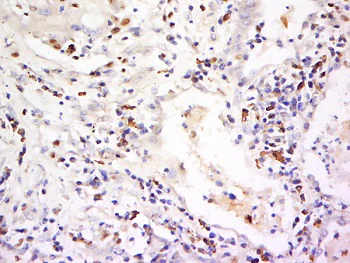 Immunohistochemistry (Formalin/PFA-fixed paraffin-embedded sections) - Anti-CD94 antibody (AB217362)