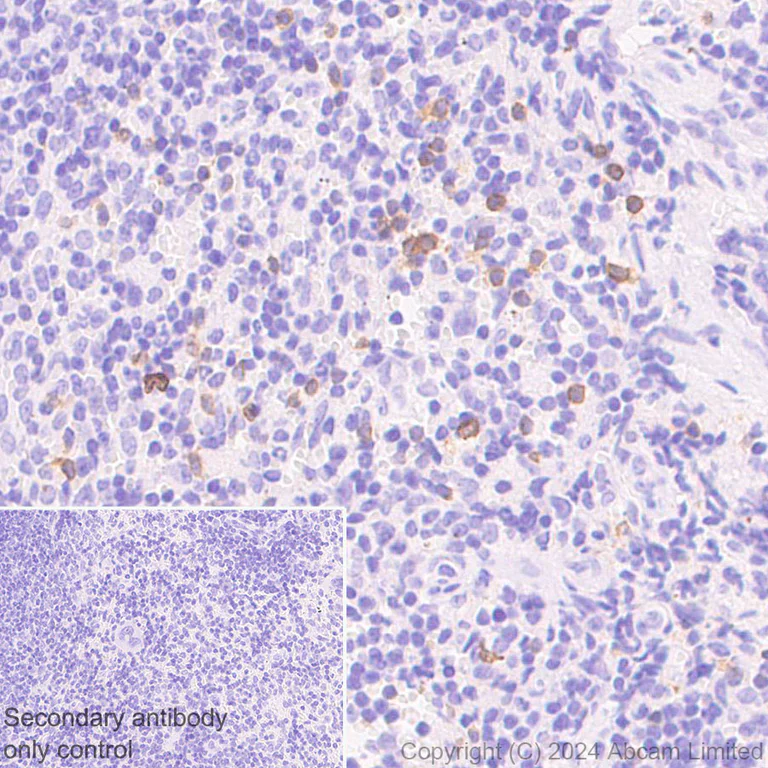 Immunohistochemistry (Formalin/PFA-fixed paraffin-embedded sections) - Anti-CD94 antibody[EPR26343-41] (AB322460)