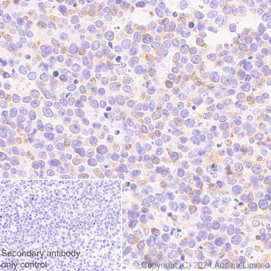 Immunohistochemistry (Formalin/PFA-fixed paraffin-embedded sections) - Anti-CD94 antibody[EPR26343-41] (AB322460), expandable thumbnail