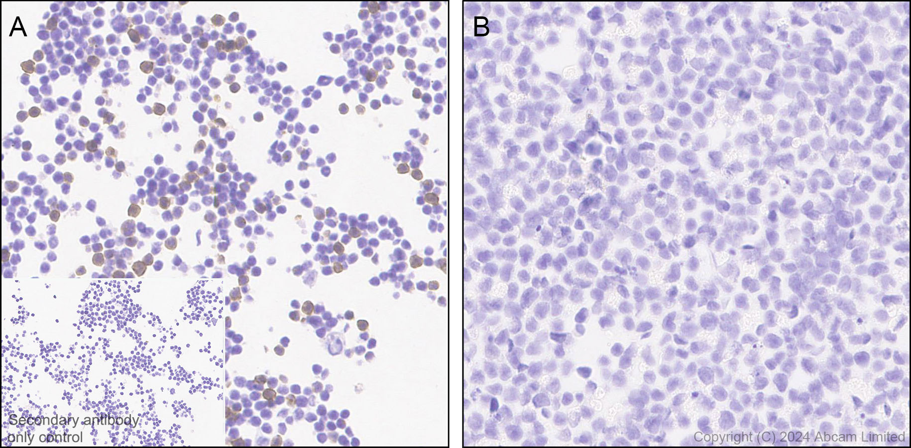 Immunohistochemistry (Formalin/PFA-fixed paraffin-embedded sections) - Anti-CD94 antibody[EPR26343-41] (AB322460), expandable thumbnail