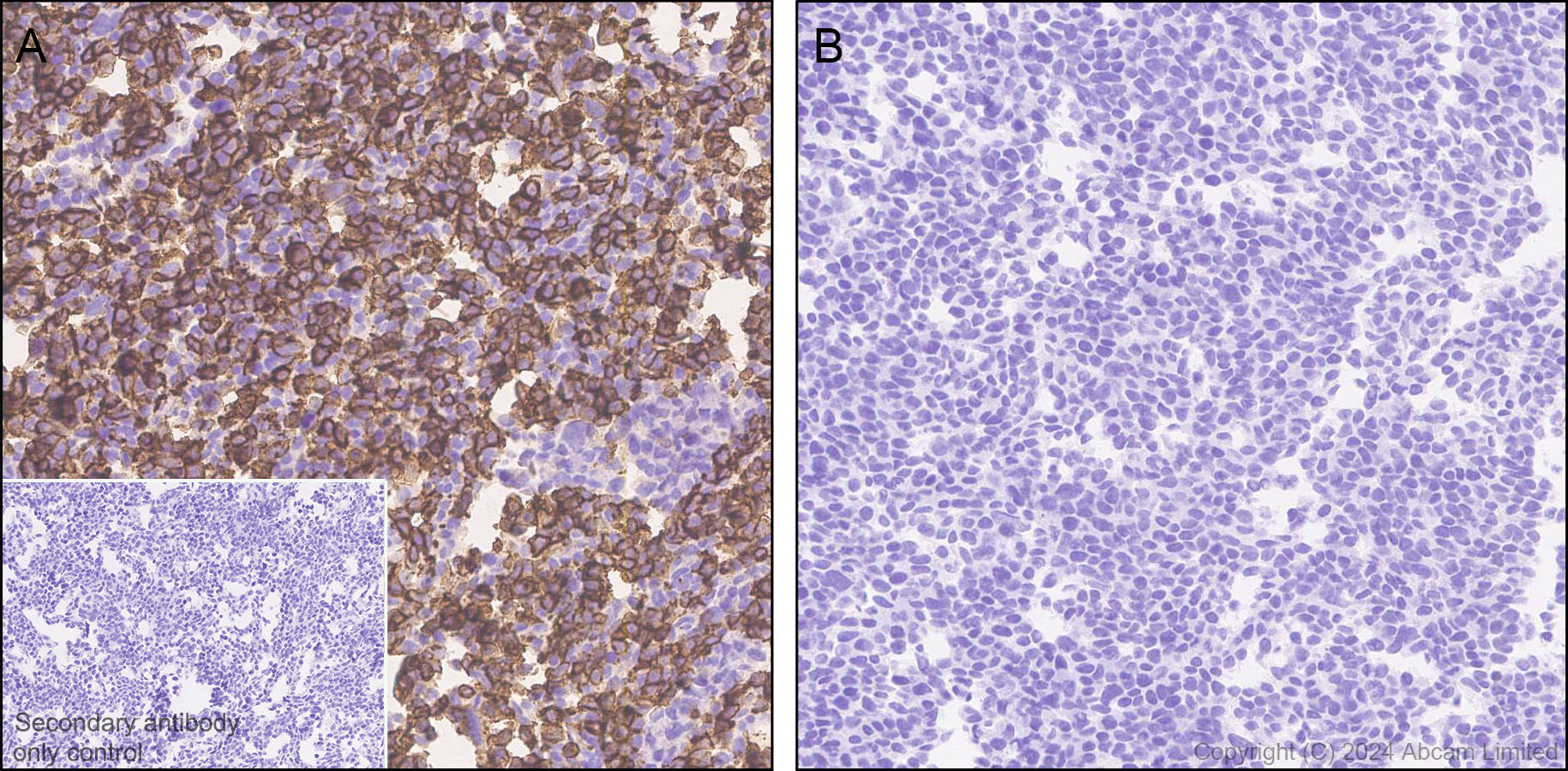 Immunohistochemistry (Formalin/PFA-fixed paraffin-embedded sections) - Anti-CD94 antibody[EPR26343-41] (AB322460), expandable thumbnail