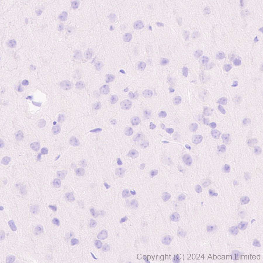 Immunohistochemistry (Formalin/PFA-fixed paraffin-embedded sections) - Anti-CD94 antibody[EPR26343-41] (AB322460), expandable thumbnail