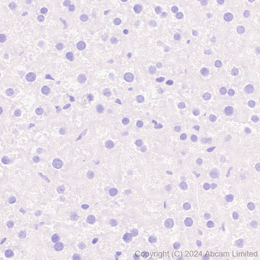 Immunohistochemistry (Formalin/PFA-fixed paraffin-embedded sections) - Anti-CD94 antibody[EPR26343-41] (ab322460), expandable thumbnail