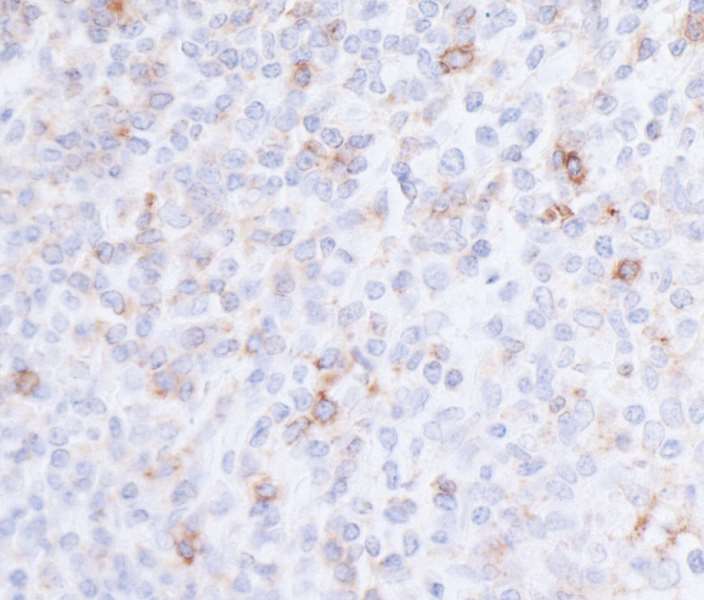 Immunohistochemistry (Formalin/PFA-fixed paraffin-embedded sections) - Anti-CD96 antibody [BLR065G] - BSA free (AB264416)