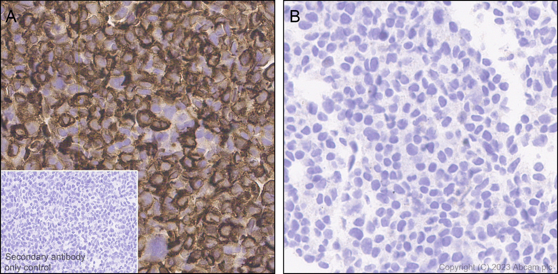 Immunohistochemistry (Formalin/PFA-fixed paraffin-embedded sections) - Anti-CD96 antibody [EPR26489-23] (AB315218)