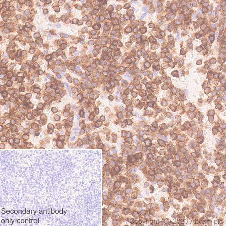 Immunohistochemistry (Formalin/PFA-fixed paraffin-embedded sections) - Anti-CD96 antibody [EPR26489-23] - BSA and Azide free (AB315219)