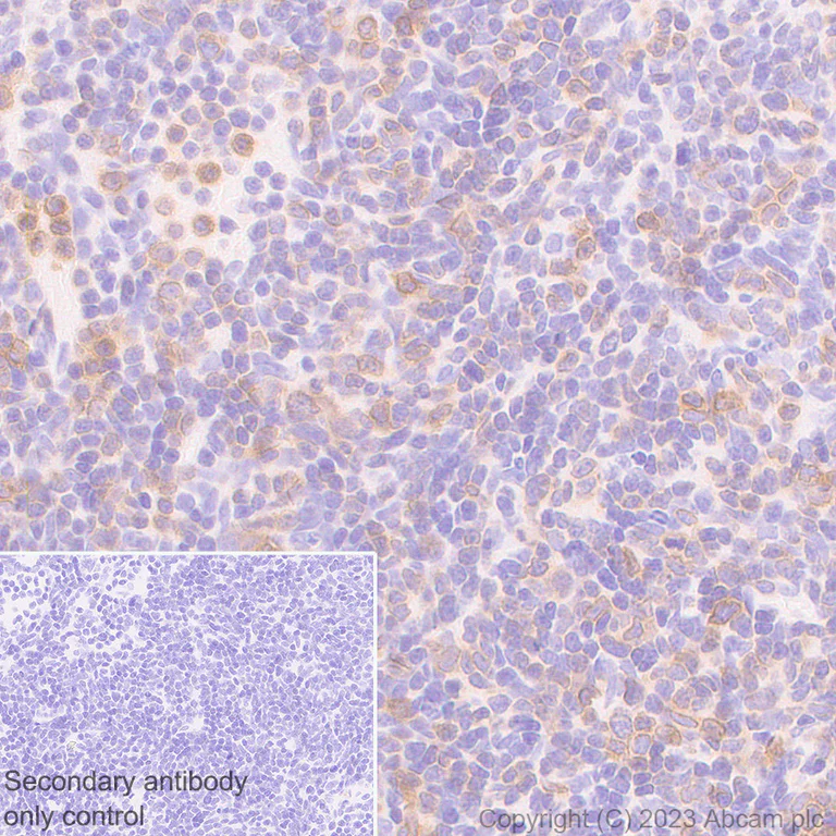 Immunohistochemistry (Formalin/PFA-fixed paraffin-embedded sections) - Anti-CD96 antibody [EPR26489-23] - BSA and Azide free (AB315219)