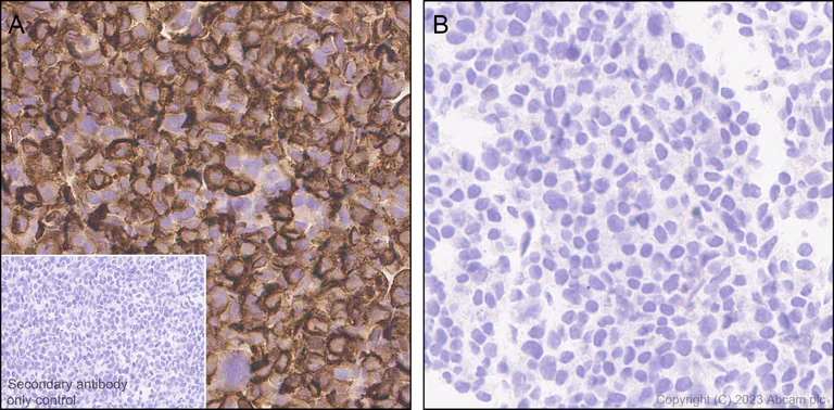 Immunohistochemistry (Formalin/PFA-fixed paraffin-embedded sections) - Anti-CD96 antibody [EPR26489-23] - BSA and Azide free (AB315219)