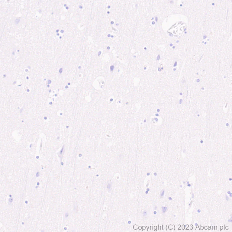 Immunohistochemistry (Formalin/PFA-fixed paraffin-embedded sections) - Anti-CD96 antibody [EPR26489-23] - BSA and Azide free (AB315219)