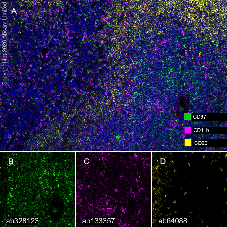 Anti-CD97 antibody [EPR30225-627] (ab328123) | Abcam
