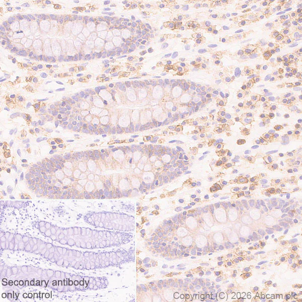 Immunohistochemistry (Formalin/PFA-fixed paraffin-embedded sections) - Anti-CD97 antibody [EPR4427] (AB108368)