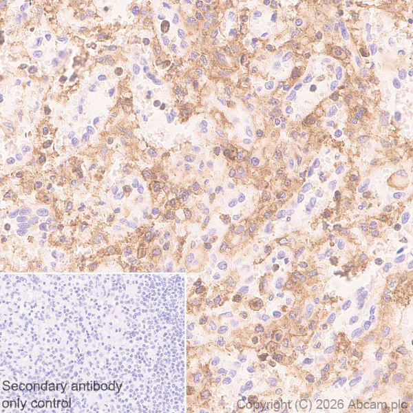 Immunohistochemistry (Formalin/PFA-fixed paraffin-embedded sections) - Anti-CD97 antibody [EPR4427] (AB108368)