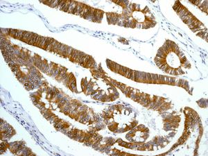 Immunohistochemistry (Formalin/PFA-fixed paraffin-embedded sections) - Anti-CD97 antibody [EPR4428] (AB134105)