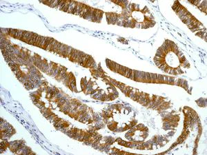 Immunohistochemistry (Formalin/PFA-fixed paraffin-embedded sections) - Anti-CD97 antibody [EPR4428] (AB134105)