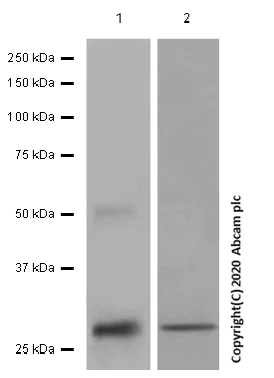 Western blot - Anti-CD97 antibody [EPR4428] (AB134105)