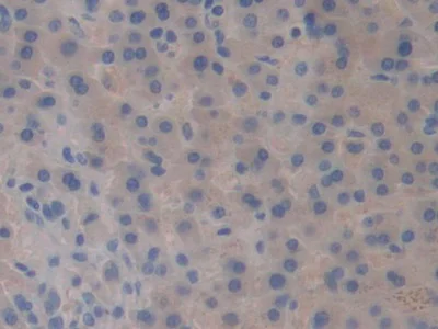 Immunohistochemistry (Formalin/PFA-fixed paraffin-embedded sections) - Anti-CD98 antibody (AB232725)