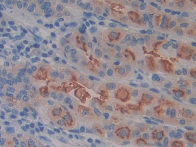 Immunohistochemistry (Formalin/PFA-fixed paraffin-embedded sections) - Anti-CD98 antibody (AB232725), expandable thumbnail