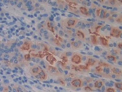 Immunohistochemistry (Formalin/PFA-fixed paraffin-embedded sections) - Anti-CD98 antibody (AB232725)
