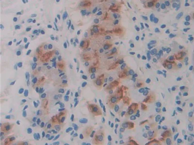 Immunohistochemistry (Formalin/PFA-fixed paraffin-embedded sections) - Anti-CD98 antibody (AB232725)