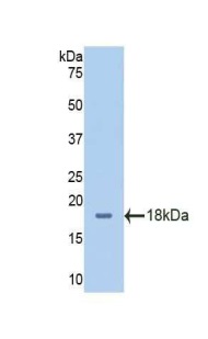Western blot - Anti-CD98 antibody (ab232725), expandable thumbnail