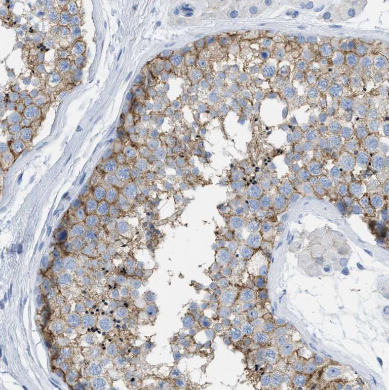 Immunohistochemistry (Formalin/PFA-fixed paraffin-embedded sections) - Anti-CD98 antibody (AB244356)
