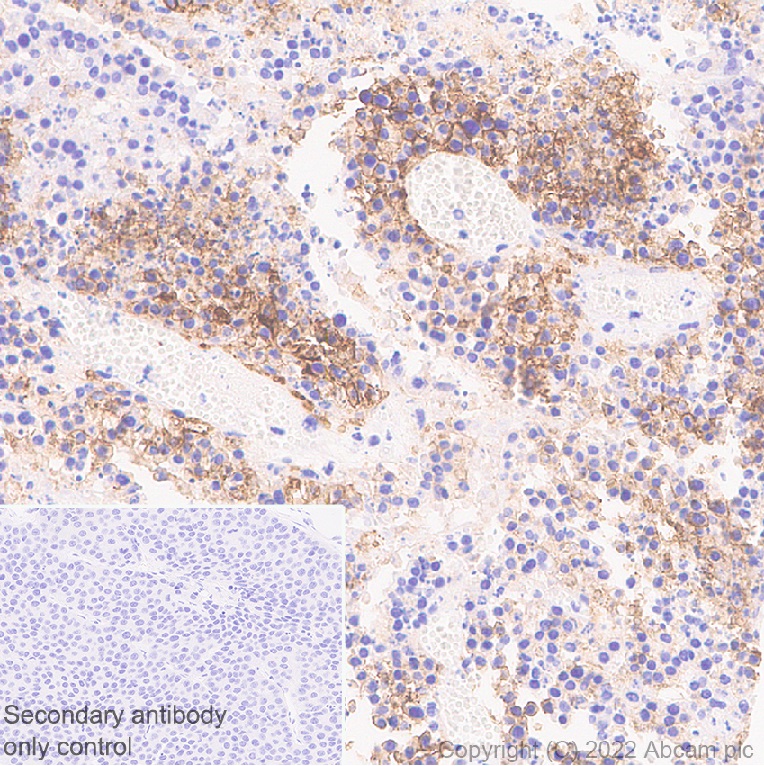 Immunohistochemistry (Formalin/PFA-fixed paraffin-embedded sections) - Anti-CD98 antibody [EPR27111-83] - BSA and Azide free (AB303511), expandable thumbnail