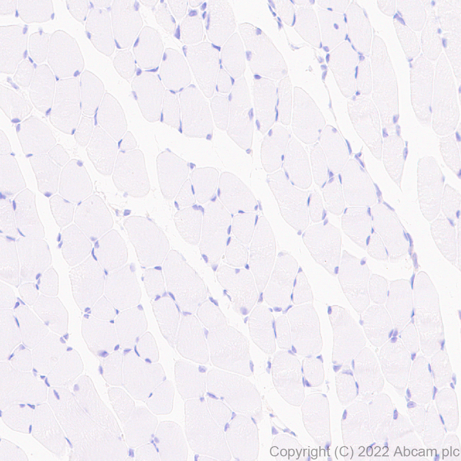 Immunohistochemistry (Formalin/PFA-fixed paraffin-embedded sections) - Anti-CD98 antibody [EPR27111-83] - BSA and Azide free (ab303511), expandable thumbnail