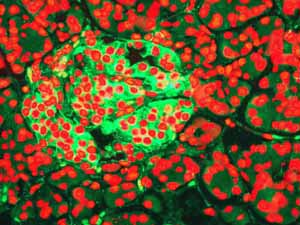 Immunohistochemistry (Formalin/PFA-fixed paraffin-embedded sections) - Anti-CD99 antibody [EPR3096] (ab108297), expandable thumbnail