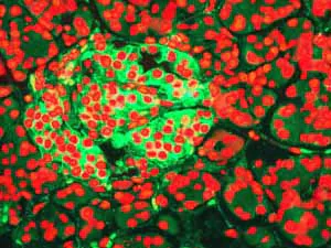 Immunohistochemistry (Formalin/PFA-fixed paraffin-embedded sections) - Anti-CD99 antibody [EPR3096] (AB108297)