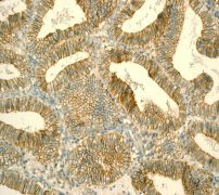 Immunohistochemistry (Formalin/PFA-fixed paraffin-embedded sections) - Anti-CD99 antibody [EPR3096] (ab108297), expandable thumbnail