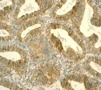 Immunohistochemistry (Formalin/PFA-fixed paraffin-embedded sections) - Anti-CD99 antibody [EPR3096] (AB108297)