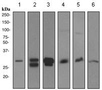 Western blot - Anti-CD99 antibody [EPR3096] (AB108297), expandable thumbnail