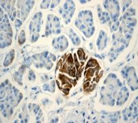 Immunohistochemistry (Formalin/PFA-fixed paraffin-embedded sections) - Anti-CD99 antibody [EPR3096] - BSA and Azide free (AB226021), expandable thumbnail