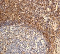 Immunohistochemistry (Formalin/PFA-fixed paraffin-embedded sections) - Anti-CD99 antibody [EPR3096] - BSA and Azide free (ab226021), expandable thumbnail