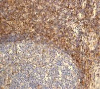 Immunohistochemistry (Formalin/PFA-fixed paraffin-embedded sections) - Anti-CD99 antibody [EPR3096] - BSA and Azide free (AB226021)