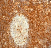 Immunohistochemistry (Formalin/PFA-fixed paraffin-embedded sections) - Anti-CD99 antibody [EPR3097Y] (AB75858)