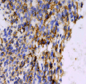 Immunohistochemistry (Formalin/PFA-fixed paraffin-embedded sections) - Anti-CD99 antibody [EPR3097Y] (AB75858), expandable thumbnail