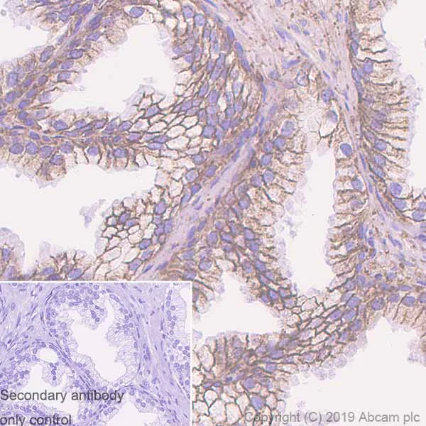 Immunohistochemistry (Formalin/PFA-fixed paraffin-embedded sections) - Anti-CD99 antibody [EPR3097Y] (AB75858)