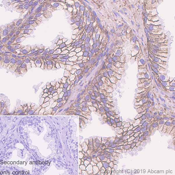 Immunohistochemistry (Formalin/PFA-fixed paraffin-embedded sections) - Anti-CD99 antibody [EPR3097Y] - BSA and Azide free (AB247410), expandable thumbnail