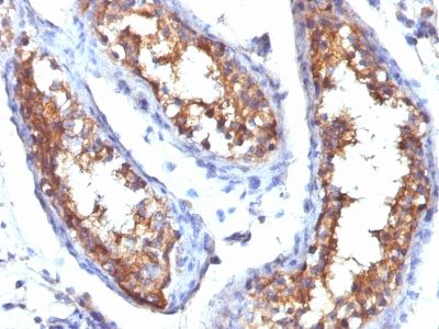 Immunohistochemistry (Formalin/PFA-fixed paraffin-embedded sections) - Anti-CD99 antibody [HO36-1.1] (AB233926)