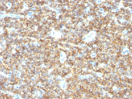 Immunohistochemistry (Formalin/PFA-fixed paraffin-embedded sections) - Anti-CD99 antibody [HO36-1.1] - BSA and Azide free (AB212605), expandable thumbnail