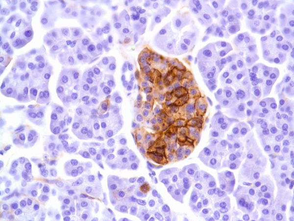 Immunohistochemistry (Formalin/PFA-fixed paraffin-embedded sections) - Anti-CD99 antibody [SP119] - BSA and Azide free (AB240990), expandable thumbnail