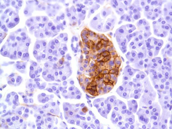 Immunohistochemistry (Formalin/PFA-fixed paraffin-embedded sections) - Anti-CD99 antibody [SP119] - BSA and Azide free (AB240990)