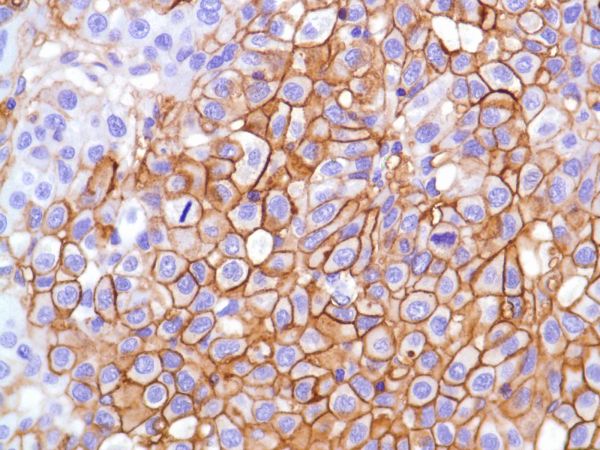 Immunohistochemistry (Formalin/PFA-fixed paraffin-embedded sections) - Anti-CD99 antibody [SP119] - BSA and Azide free (AB240990), expandable thumbnail